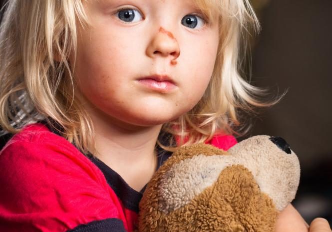  Considering Legal Action Against Your Child’s Daycare?